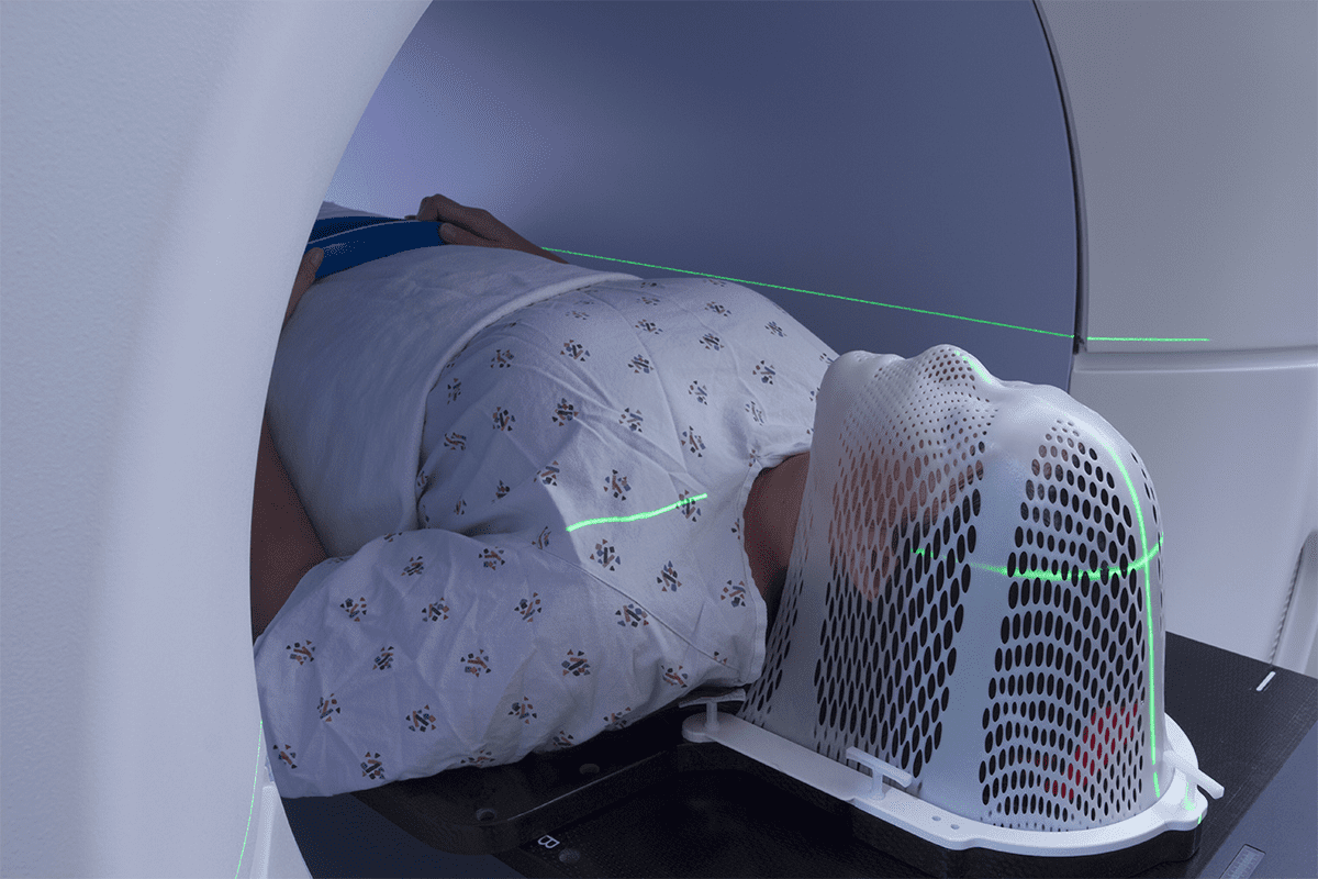 At What Stage of Cancer Is Radiotherapy Used?