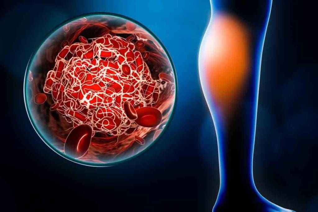 How Long Does It Take for Do Blood Clots Dissolve On Their Own ? 1 How Long Does It Take for Do Blood Clots Dissolve On Their Own ?