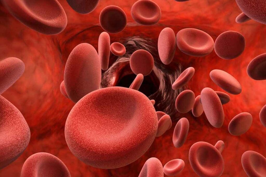 Blood Disorders: 15 Common Types and Their Key Hematology Features 3 Blood Disorders: 15 Common Types and Their Key Hematology Features