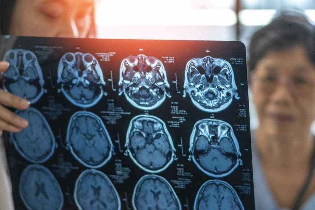 Do MRIs Show Broken Bones That X-Ray Cannot?