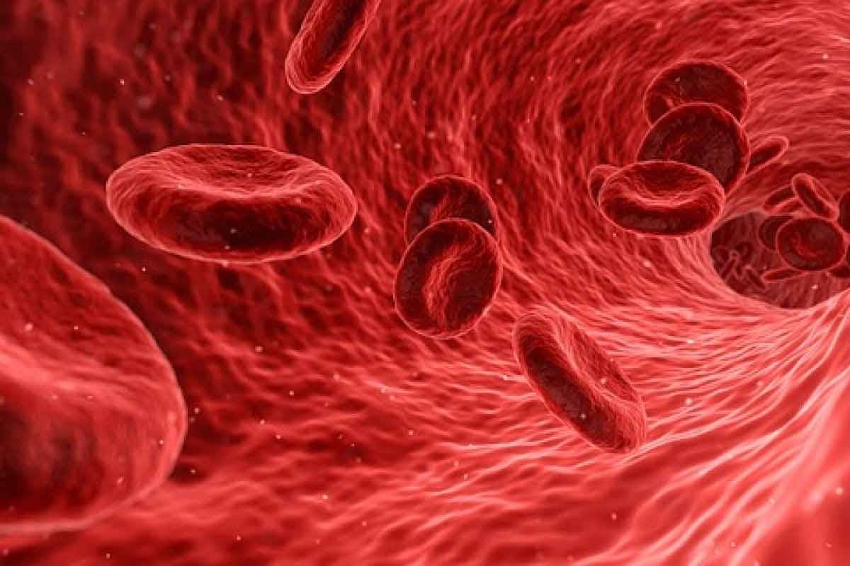 Aplastic Anemia Crisis: 8 Key Facts About Etiology, Blood Film, and Prognosis