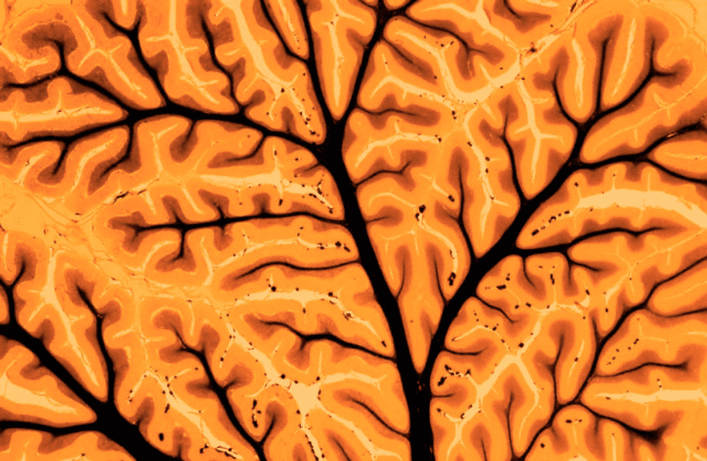 7 Shocking Facts About Anesthesia Long-Term Side Effects