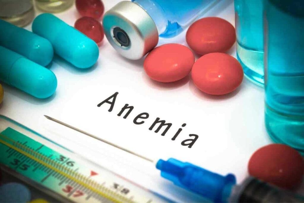 How To Cure Aplastic Anemia: Amazing Treatment Guide
