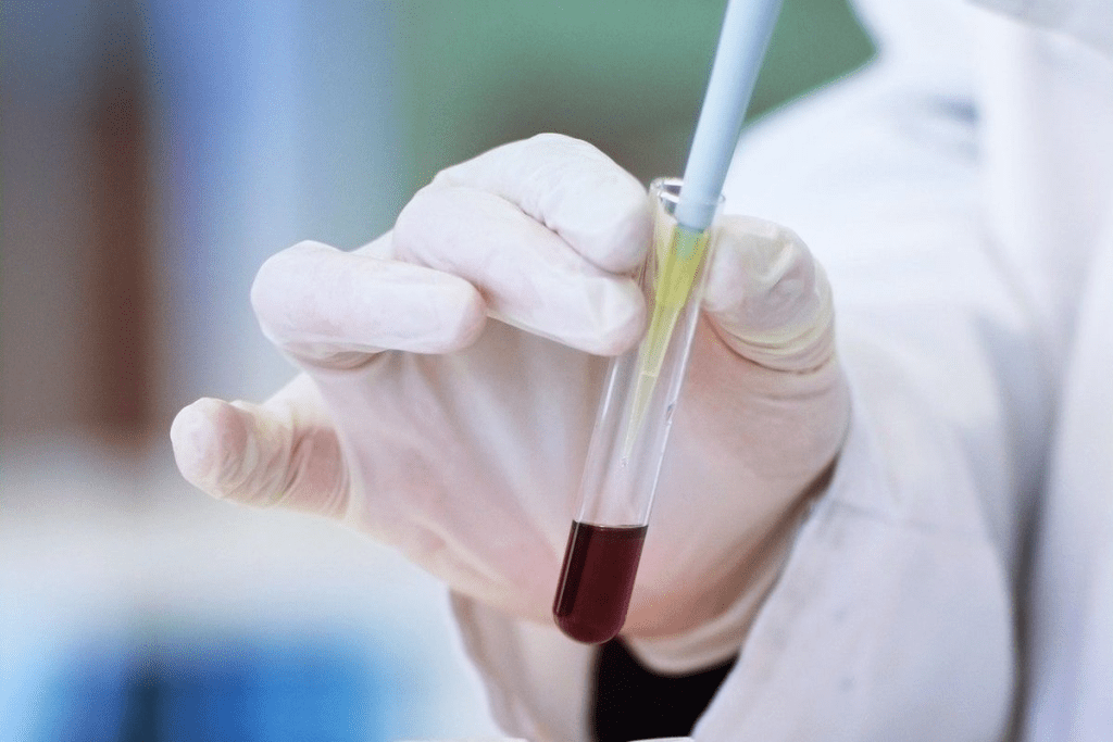 Vital Reasons to Visit a Trusted Hematology