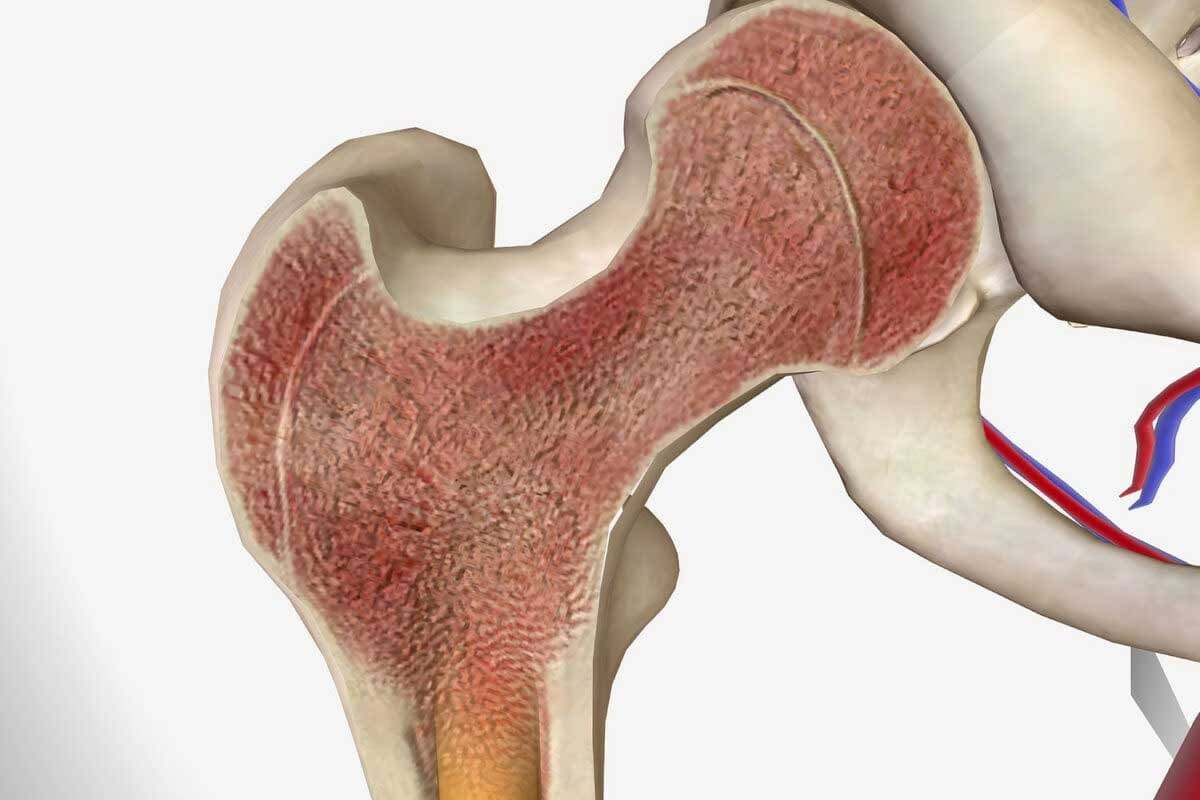Which Type Of Anemia Is Caused By Bone Marrow Failure: Crucial Answer
