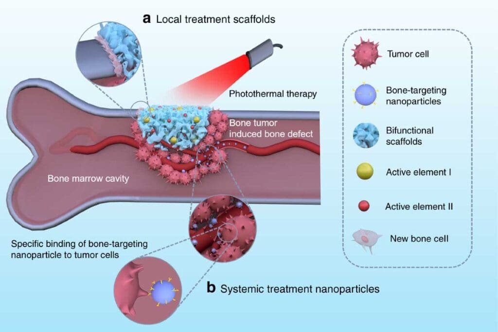 Which Type Of Anemia Is Caused By Bone Marrow Failure: Crucial Answer