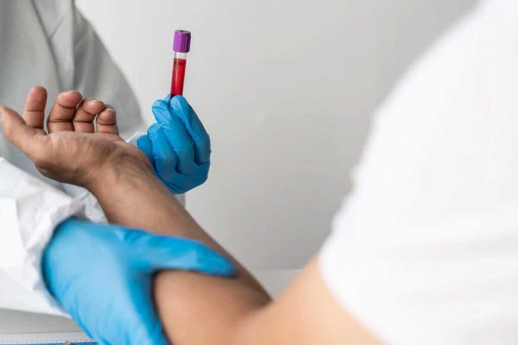 Aplastic Anemia Peripheral Smear: Key Lab Findings