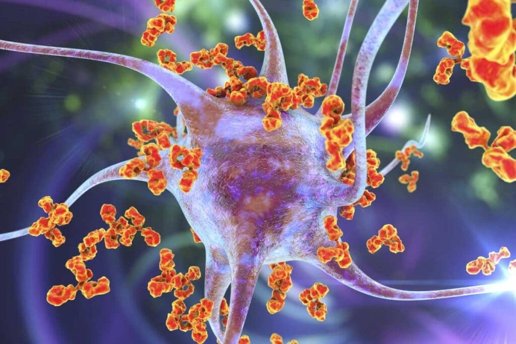 How to Treat Aplastic Anemia: Step-by-Step Medical and Therapeutic Options