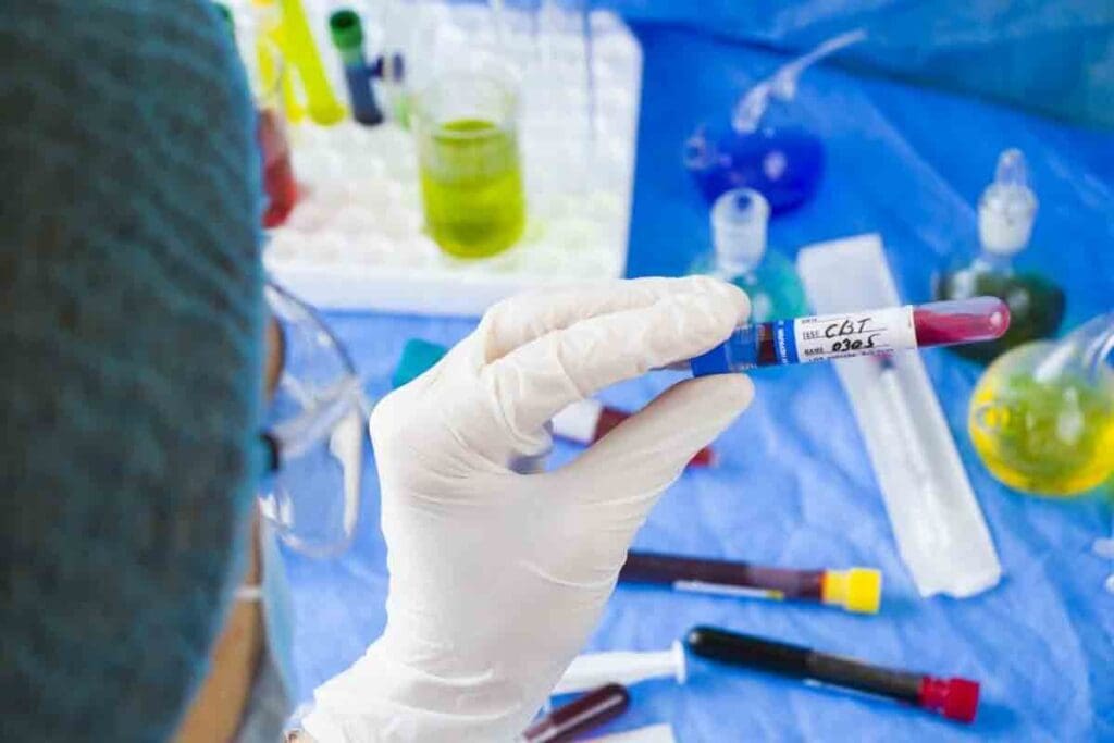 CBC Of Aplastic Anemia: 7 Key Lab Findings