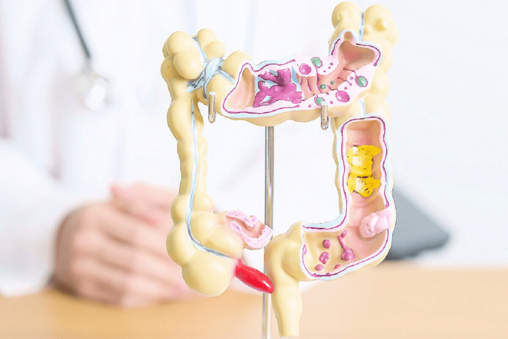 How Long Is the Colon? Fast-Spread Cancer Facts 3 How Long Is the Colon? Fast-Spread Cancer Facts