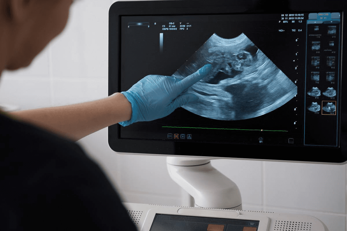 Signs of a Bad Ultrasound: Alarming Delay