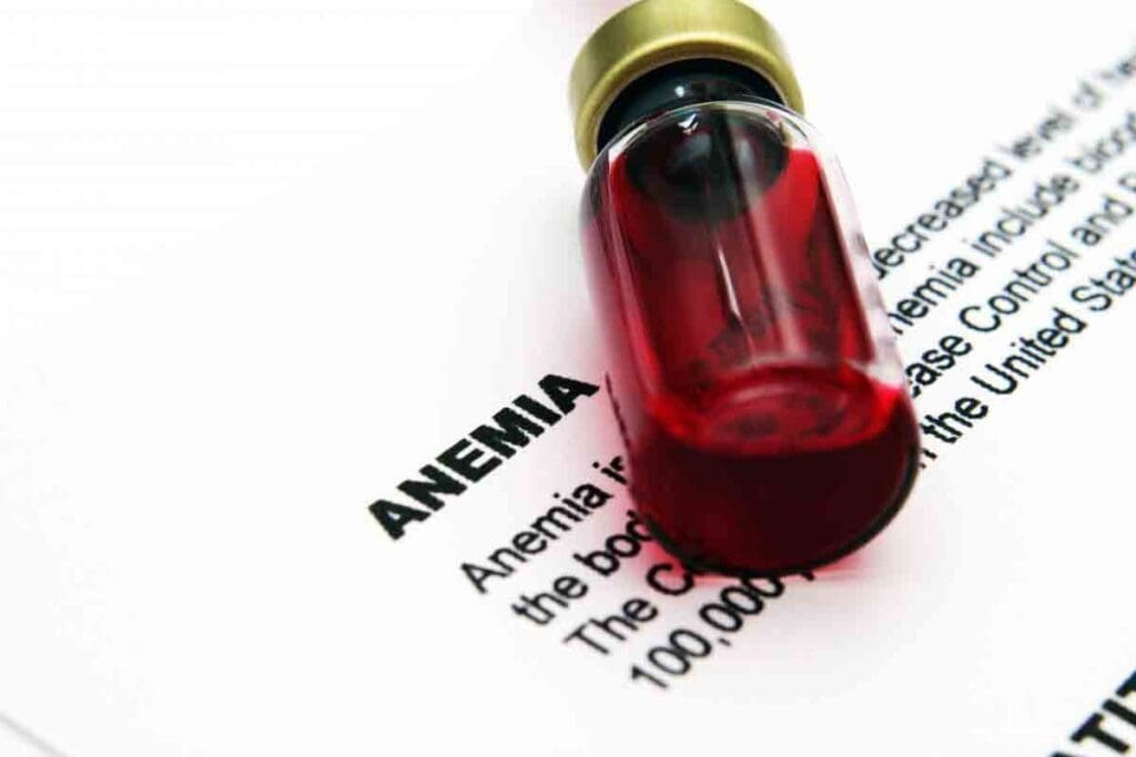 Is Anemia Autoimmune Disorder: Key Facts & ACD Term