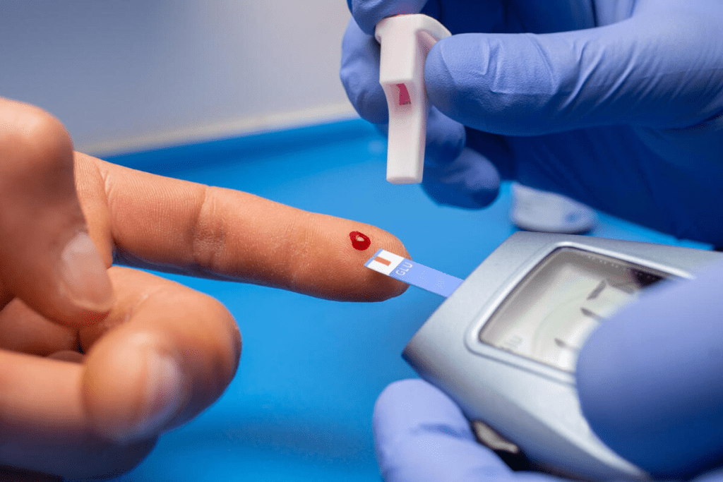 MCV Blood Test: The Ultimate Guide to Results