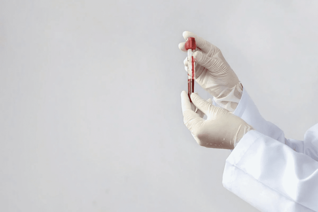 What Is a Hematologic Disorder? The Best Guide