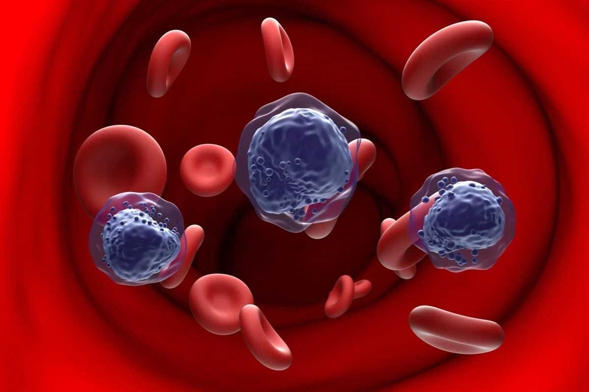 Acute B Leukemia: 10 Key Survival Facts & Rates