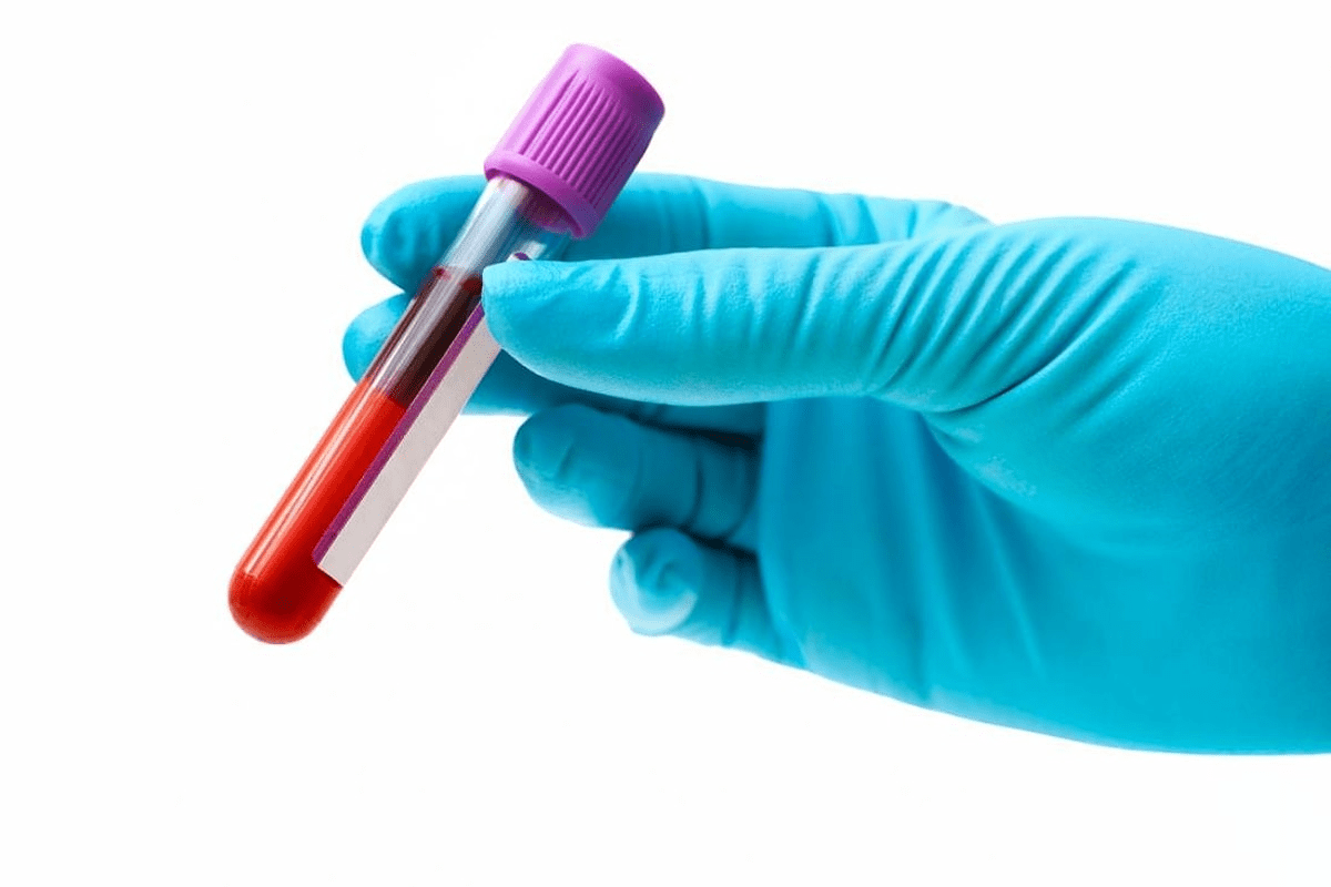 Clinical Examination of Anemia: A Powerful Guide