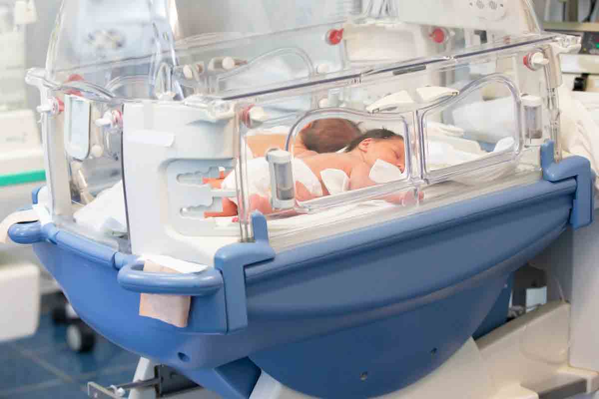 Infant AML: 7 Crucial Facts for Newborns