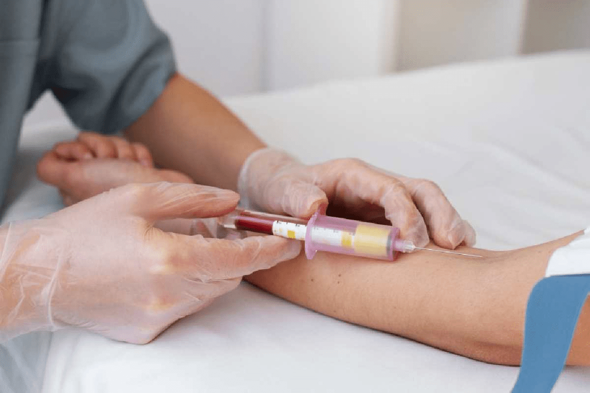 Blood Hemogram Test: The Ultimate Guide
