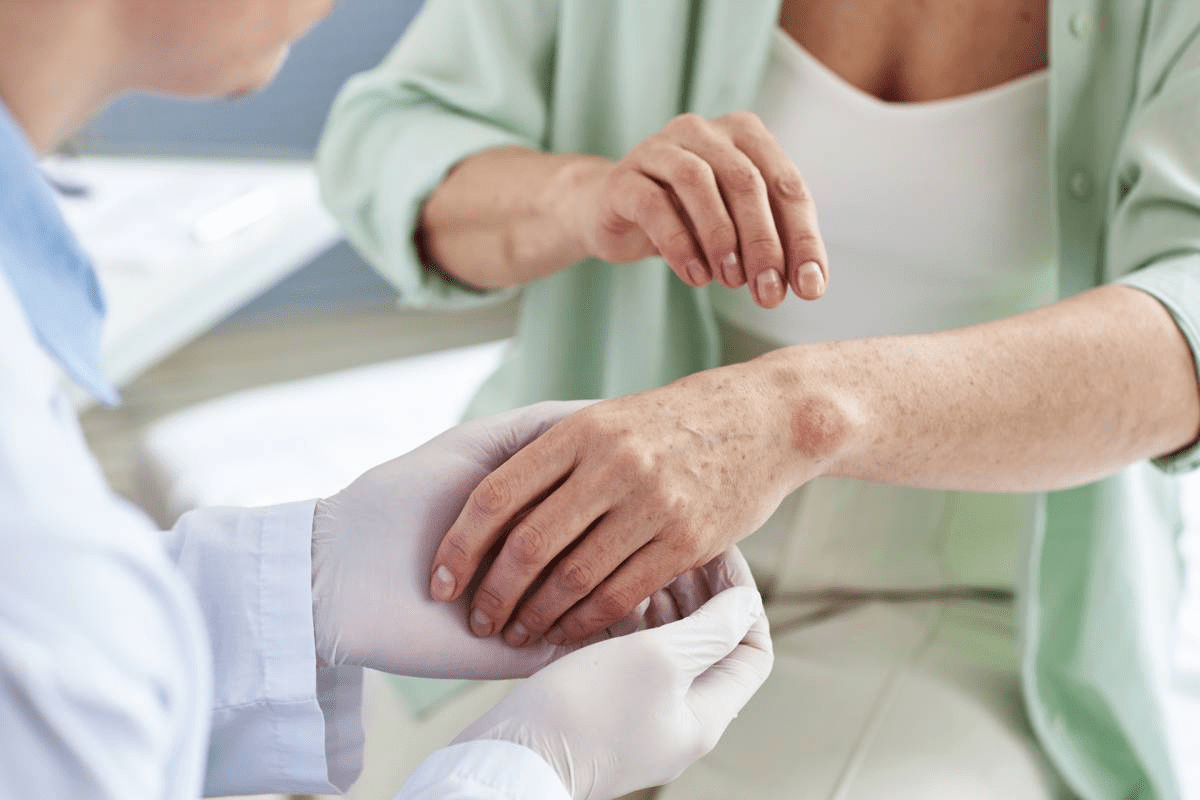 What Type of Doctor Treats Autoimmune Disorders?