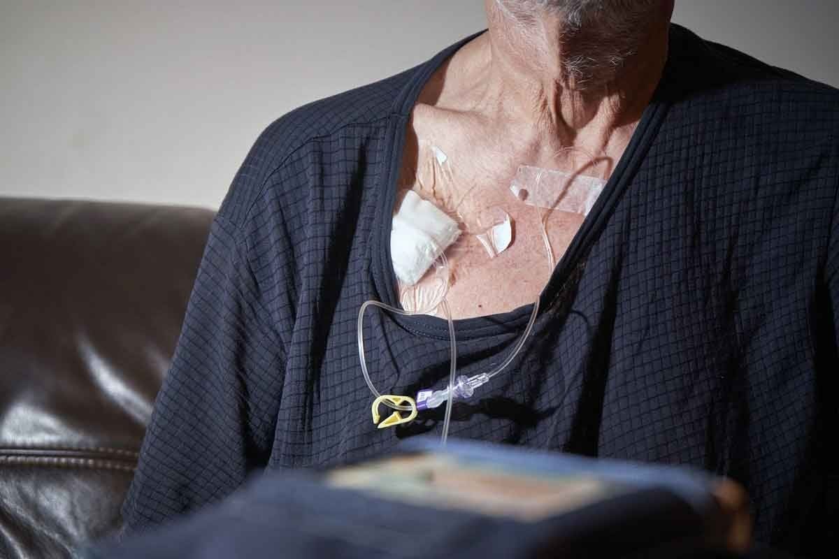 Sickle Cell Disease Life Expectancy: Key Factors & Facts