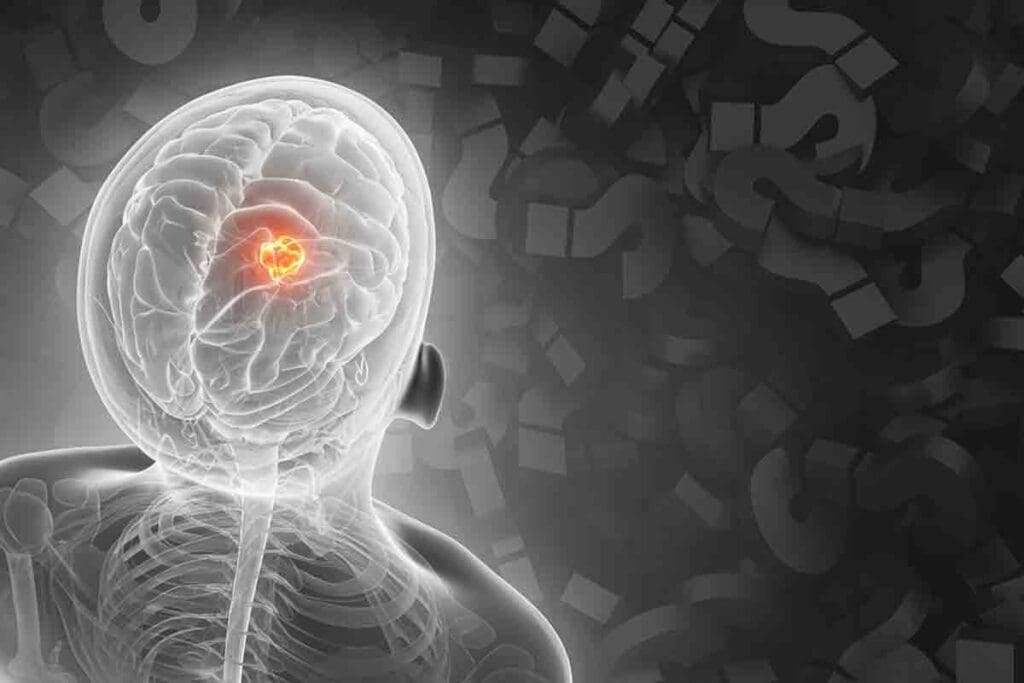 Cerebellar Tumor Symptoms: 15 Key Brain Tumor Warning Signs