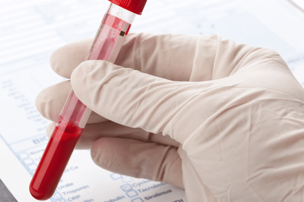 Causes of Autoimmune Diseases: Triggers 1 Causes of Autoimmune Diseases: Triggers