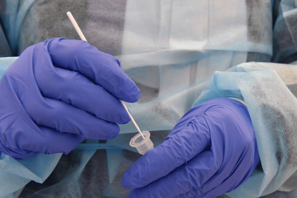 Causes of Autoimmune Diseases: Triggers 3 Causes of Autoimmune Diseases: Triggers