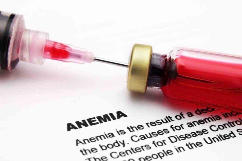 7 Common Childhood Anemia Causes & Symptoms to Know 3 7 Common Childhood Anemia Causes & Symptoms to Know
