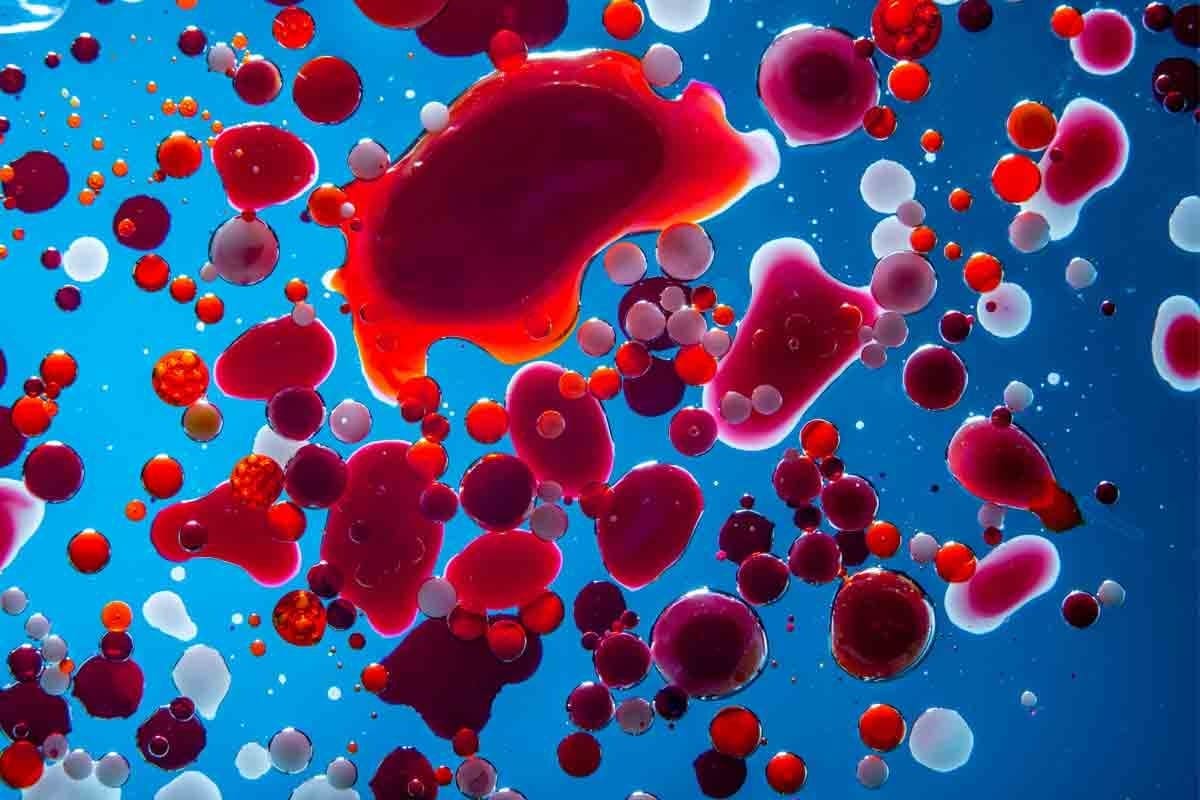 White Cells Eating Red Cells: Crucial Autoimmune Attack