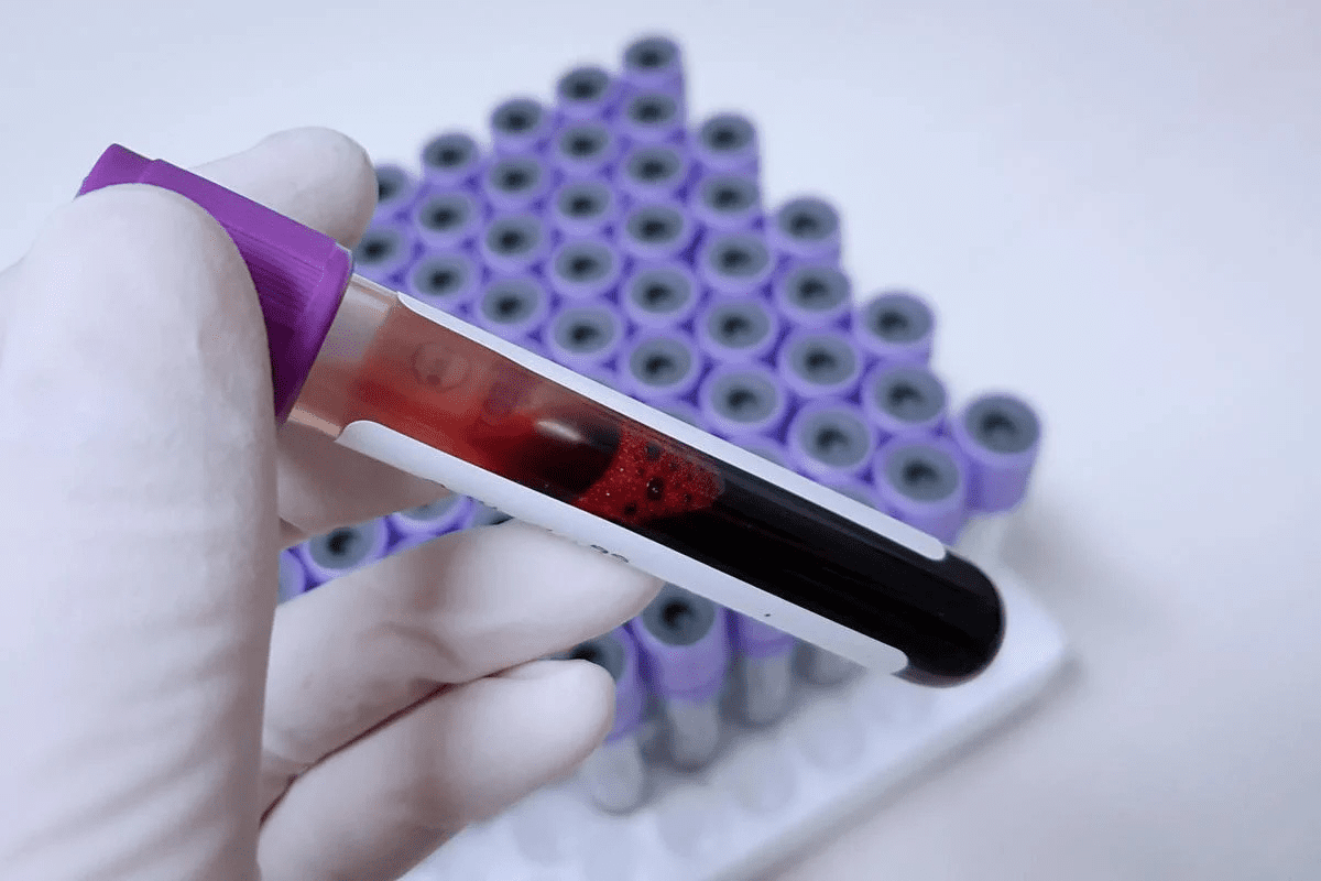 What Level of Platelets Is Dangerous? Crucial Facts