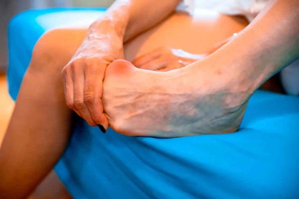 Sarcoma Shin Bone: What Is Ewing Sarcoma Explained