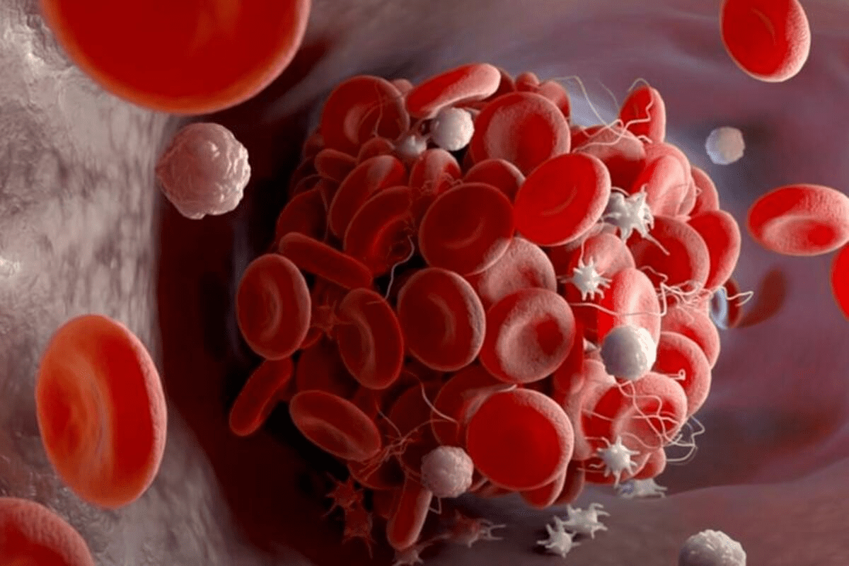 RBC Blood Test: 7 Critical Abnormal Results You Must Know