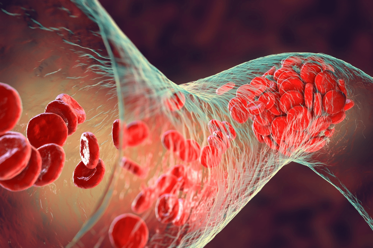 Coagulation Disease of Blood: An Essential Guide