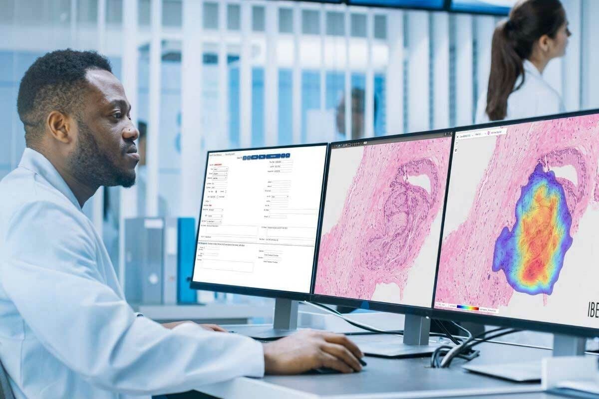 FDG Scan: An Amazing Guide to Cancer Detection