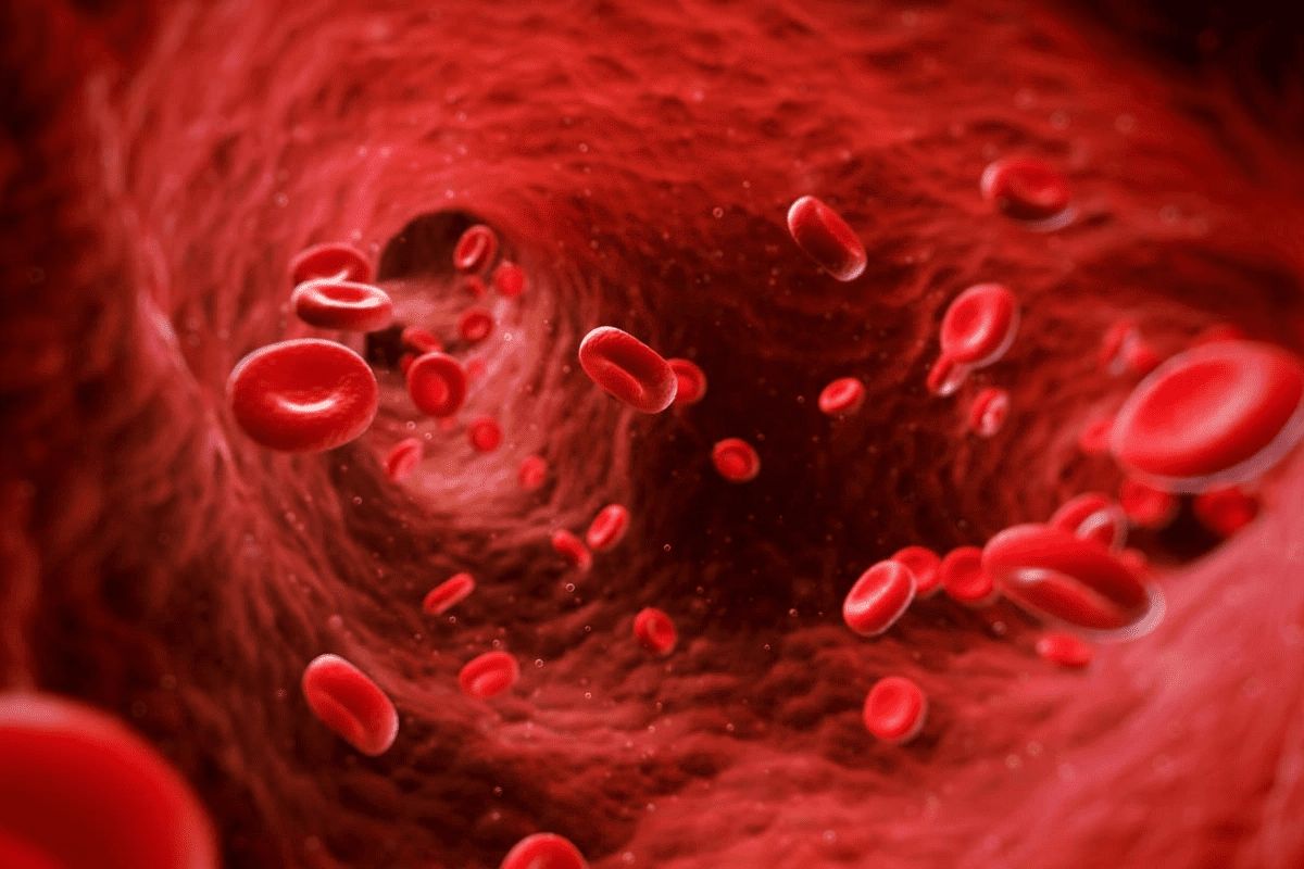 Hemolytic Anemia: Urgent Negative Blood Disease