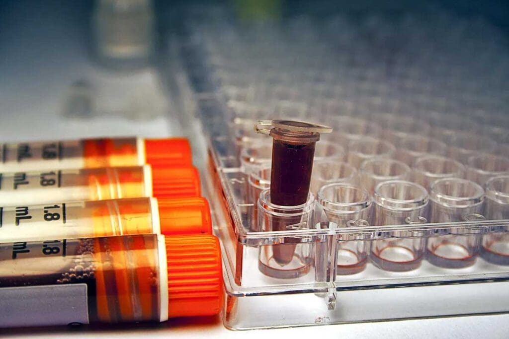 Chemotherapy Regimens: Main Types and Key Combinations 1 Chemotherapy Regimens: Main Types and Key Combinations