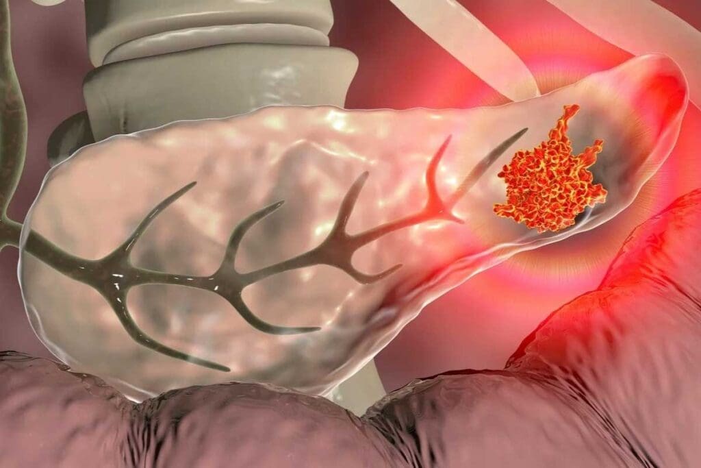 Chemotherapy Regimens: Main Types and Key Combinations 3 Chemotherapy Regimens: Main Types and Key Combinations