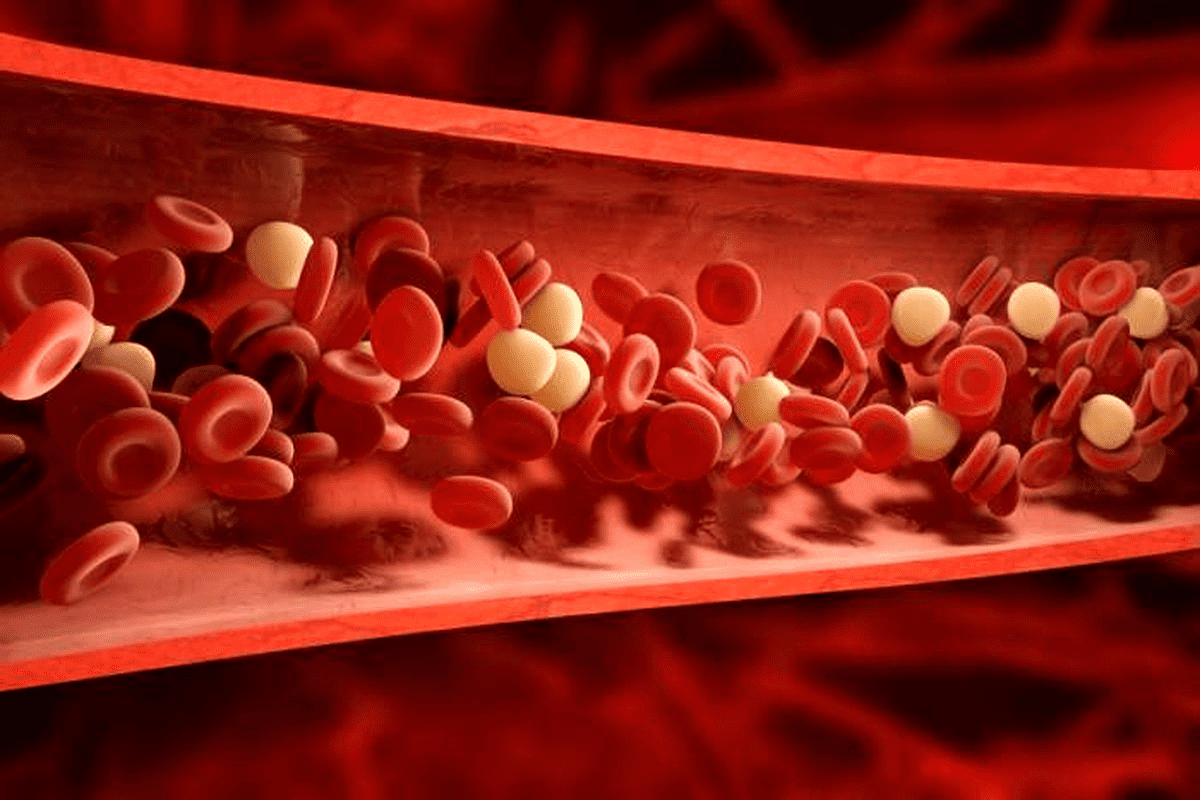 What Causes Blood Clots? The Shocking Secrets