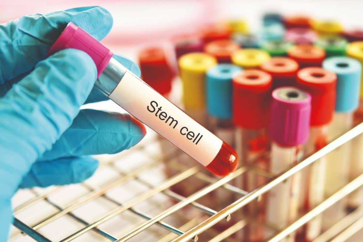 Recovery Challenges: How Sick Do You Get? stem cells come from afterbirth?