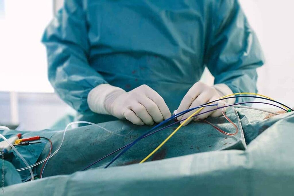 Is Catheter Ablation Safe? Key Facts & Risks