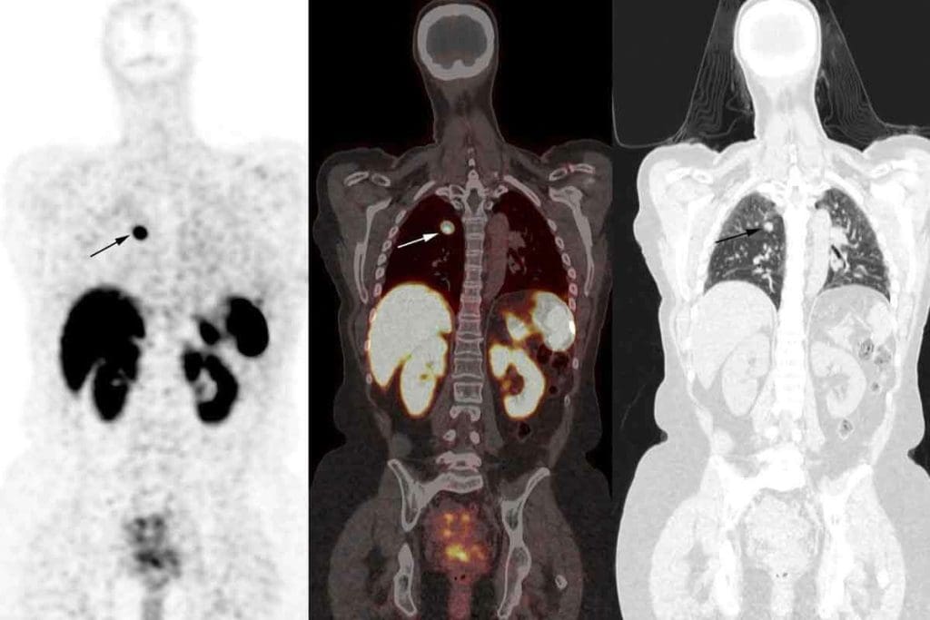 Female Normal Bone Scan Images: The Definitive Guide