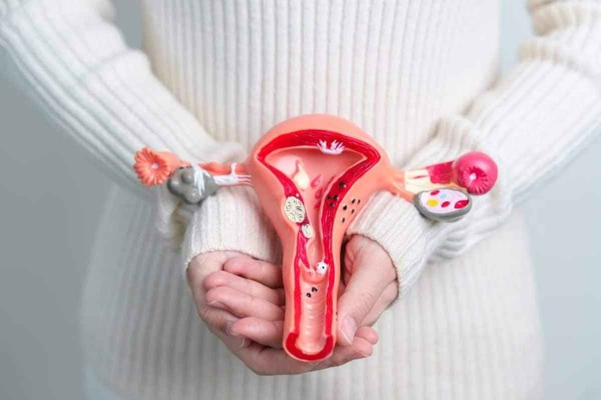 Ablation for Fibroids Recovery q: 7 Facts