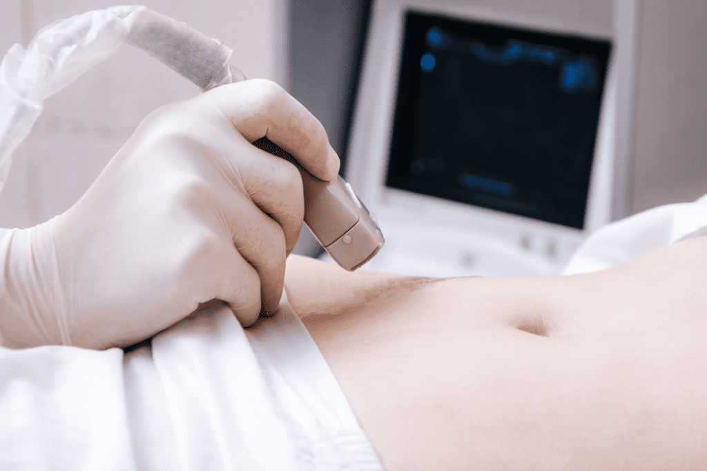 Can You See Cancer in the Abdomen with Ultrasound? The Ultimate Guide