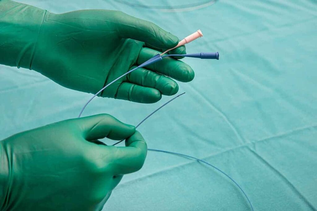 Is Angiography Surgery? Key Details Explained