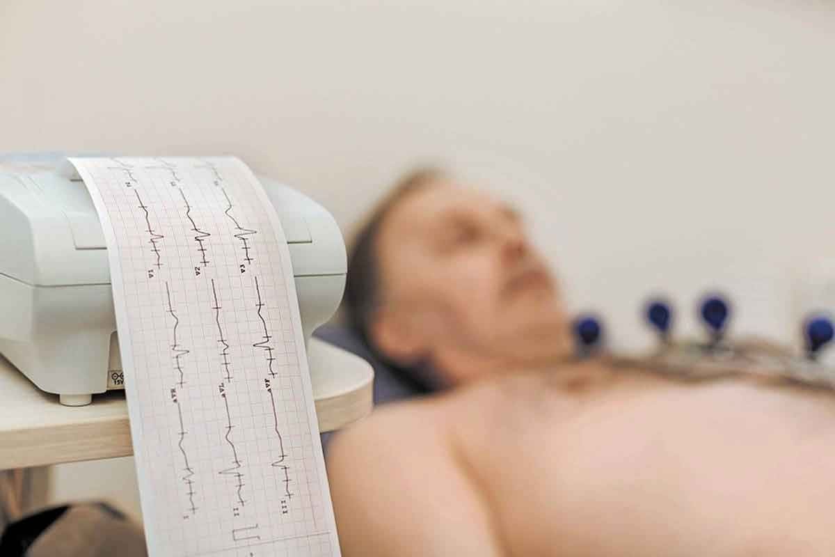 Angiogram Thru Wrist: Step-by-Step Guide