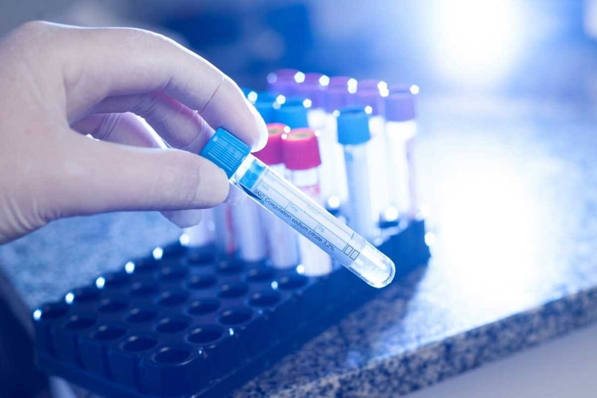 Coagulation Disorders — 7 Key Facts on Clotting Problems