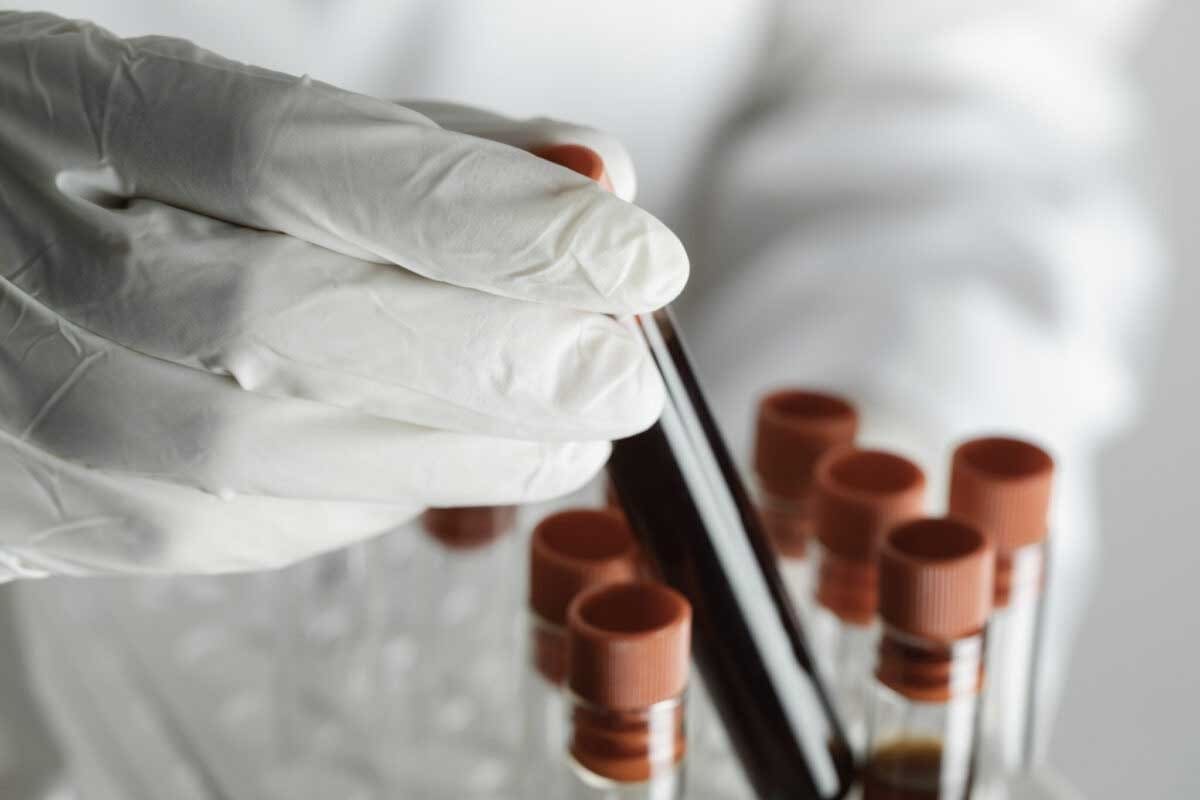 Signs of Clotting Disorder – 12 Key Symptoms Explained