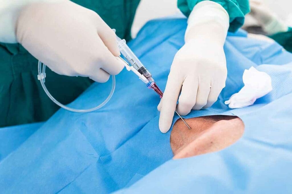 Stent Graft Aorta: 7 Key Facts About AAA Stent Placement and Recovery