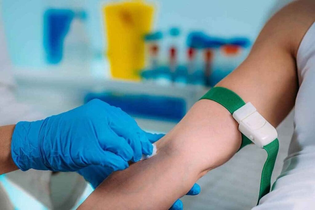 polycythaemia diagnosis – 7 Key Tests Explained