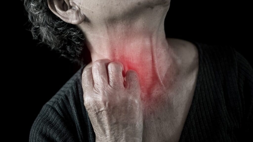 Neck Aneurysm Symptoms: 7 Key Signs of Carotid Artery Aneurysm 3 image 7239 LIV Hospital